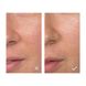 Vinopure Матуючий флюїд для проблемної шкіри обличча "Досконала шкіра " 40 мл